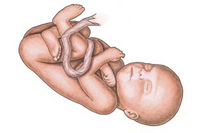 Aborto. Del derecho a la vida.